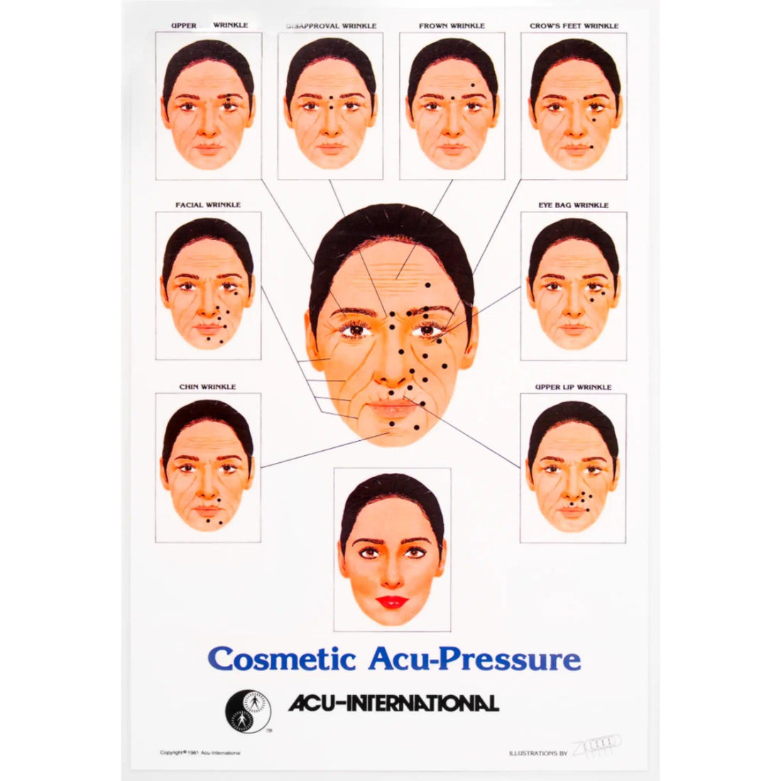 CosmeticAcupunctureChart